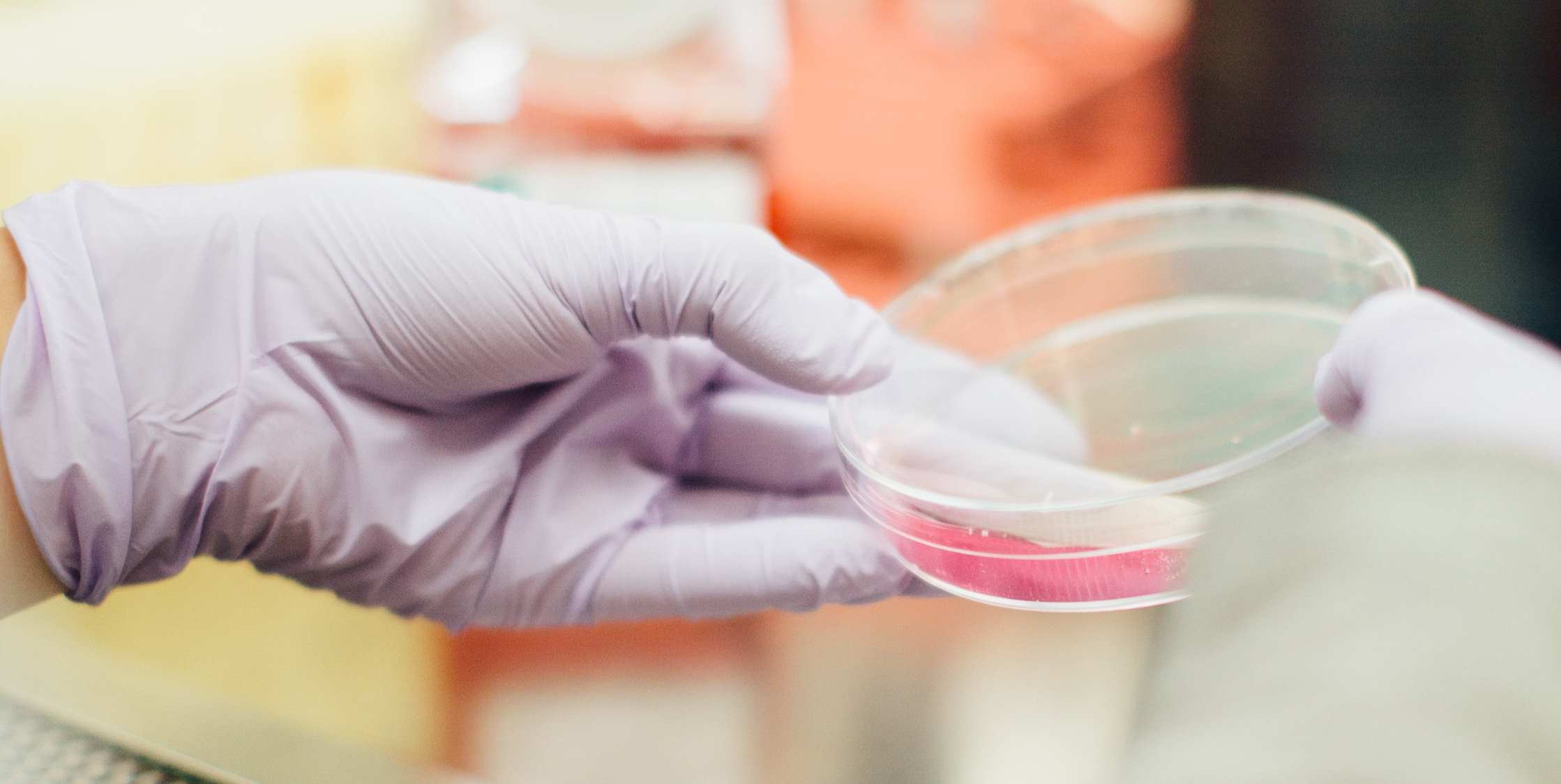 gloved hand holding a petri dish
