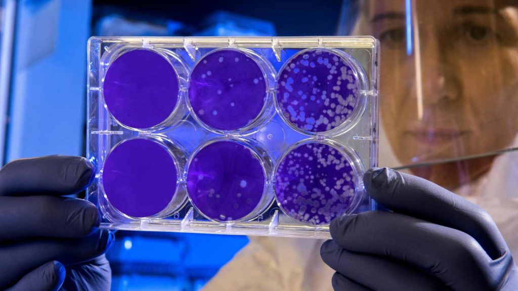 A scientist holding a container of petri dishes - challenge test cosmetics