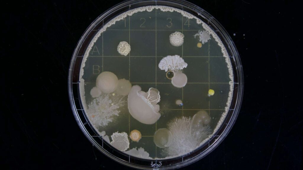 close-up image of a petri dish with microorganisms
